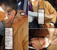 هذه حقيقة صور الشخص المدرج في دمائه ومديرية "الحموشي" تدخل على الخط