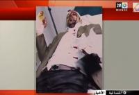 عن تنامي ظاهرة الاعتداء بالسلاح الأبيض بالبيضاء