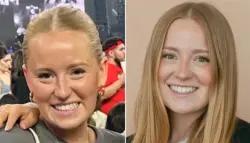 حقنة بوتوكس تُجمّد وجه شابة أمريكية وتُخفي ابتسامتها بشكل صادم