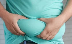 دراسة: السمنة قبل سن الثلاثين تزيد خطر الوفاة المبكرة بنسبة 75%