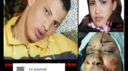 خولة… التي “شرملها” زوجها: “طلقو راجلي ولا غادا نقتل راسي”