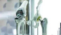 اختراق علمي.. سبائك الزنك بحبيبات أكبر تُحدث ثورة في تصميم الغرسات القابلة للتحلل