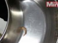 بالفيديو: طبيبة تخرج دودة من عين مراهق بيروفي