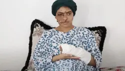 الأميرة لالة مريم تتدخل شخصيا وتأمر بالتكفل الكامل بحالة الشابة إيمان التي مزق طليقها وجهها