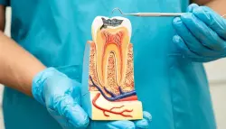 علاج التهابات الأسنان قد يحسّن سكر الدم ويخفف الالتهاب المزمن