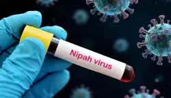 اليابان تبدأ اختبار لقاح جديد ضد فيروس نيباه على البشر