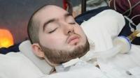 بعد 15 عاما من الغيبوبة.. فيديو لـ"الأمير السعودي النائم" يثير ضجة على مواقع التواصل! (فيديو)