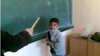 صفرو : أستاذ "يؤدب" تلميذا ويسبب له كسورا خطيرة