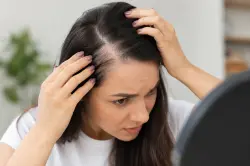 وصفة طبيعية لعلاج فراغات الشعر وزيادة كثافته