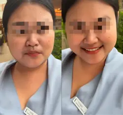 التنمر على شعر وجه عاملة فندق في تايلاند يضع مؤثرة مغربية في ورطة