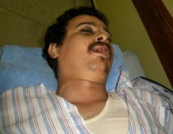  وفاة شخص بآسفي وشكوك أمنية حول نشاطه في \"حركة 20 فبراير\"