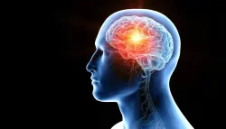 قطرات في الأنف.. تقنية واعدة لعلاج سرطان دماغ قاتل دون جراحة