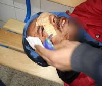 السيبة هادي..."مقرقبين" يهاجمون صاحب محل ويصيبونه بجروح خطيرة بالقنيطرة