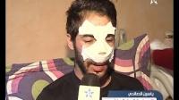 عملية جراحية ناجحة للصالحي على مستوى الأنف
