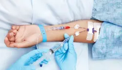 العلاج الكيميائي قبل الجراحة.. دراسة تغيّر ترتيب مواجهة سرطان البنكرياس المبكر
