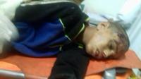 خطير:العثور على طفل مبتور الرجل بمحاذاة سكة القطار وهذه التفاصيل