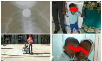 فضيحة... المستشفيات تتقاذف طفلا بلع قطعة نقدية ووالداه يتوسلان والأمن يدخل على الخط