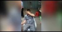 شاهد.. كيف انتقمت سلحفاة من رجل قطع جسمها نصفين