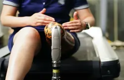 علماء روس يبتكرون أطرافا اصطناعية من ألياف الكربون