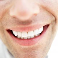 التدخين والنسكافيه والشاي مصائب تهدد الأسنان