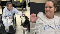 رحلة تجميل تنتهي بمأساة.. سيدة كندية تفقد أطرافها بعد مضاعفات خطيرة خارج البلاد