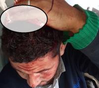 بالصور:اعتداء وحشي يطال سائق حافلة بالجديدة وهذا ما وقع