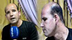 شاب من طنجة يروي بحرقة: تعرضت للكريساج.. سرقوني وشوّهوا وجهي، والناس ولات كتخاف مني