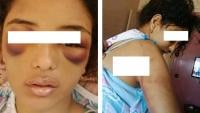 زوج يعذب زوجته بطريقة وحشية ببرشيد