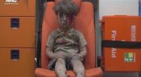روسيا تنفي مسؤوليتها عن إصابة الطفل السوري عمران في قصفها لحلب