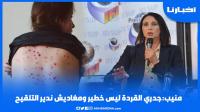 منيب: جدري القـردة ليس خطير ومغاديش ندير التلقيح والساحة أوسع من البرلمان