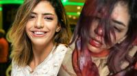 مغنية الراب”سيكو كوين” تخضع لعملية جراحية (صورة)