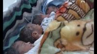 امرأة تنجب 5 توائم بزاكورة