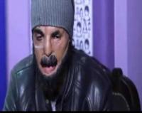 سكيزوفرين غاضبا ...أعباد الله أوقفوا جرائم هاد الطبيب القاتل
