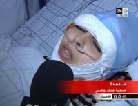 زوج يعتدي بوحشية على زوجته بالبيضاء