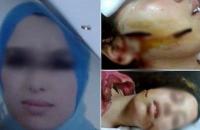 شاب يشرمل وجه خطيبته بالسيف في مراكش و يلوذ بالفرار