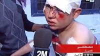 حادثة سير خطيرة بإقليم تنغير تسببت في وفاة شخص و إصابة 48 آخرين