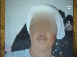وفاة سميرة المغتصبة بالقوة بعد إهمال طبي ببركان‏