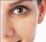 طريقة لمنع ظهور مسام الوجه