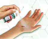 علماء يطورون بخاخا طبيا يوقف النزيف خلال ثانية واحدة فقط