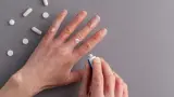 دواء جديد يُحدث اختراقاً في علاج إكزيما اليد المزمنة