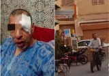 دعوات حزبية لطرد فرنسي من المغرب بعد اعتدائه على شخص من ذوي الاحتياجات الخاصة